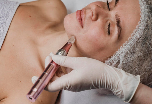 The Benefits of Combining Microneedling with Stem Cells