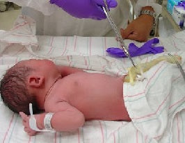 The Lifesaving Potential of Cord Blood Banking