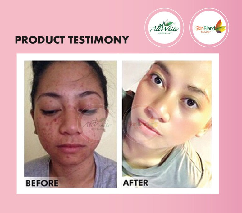 AllWhite PLANT Placenta Oatmeal Soap Moonspells Beauty