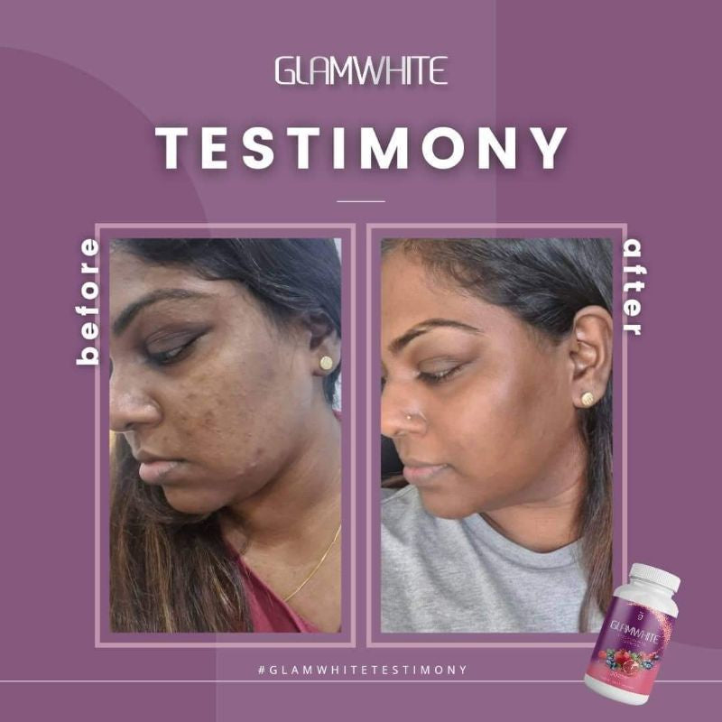 Glamwhite Beauty Tablets Moonspells Beauty