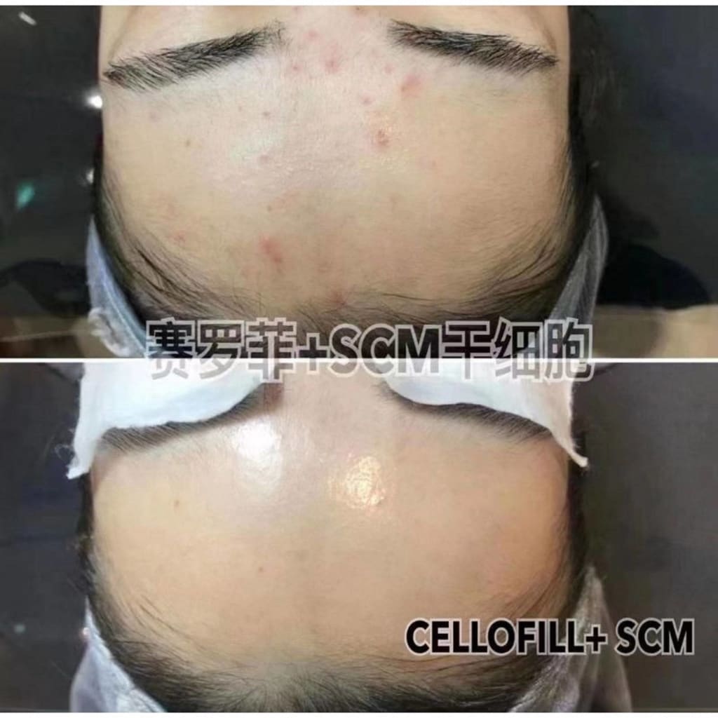 Korea Glamour Care SCM Stem Cells Moonspells Beauty