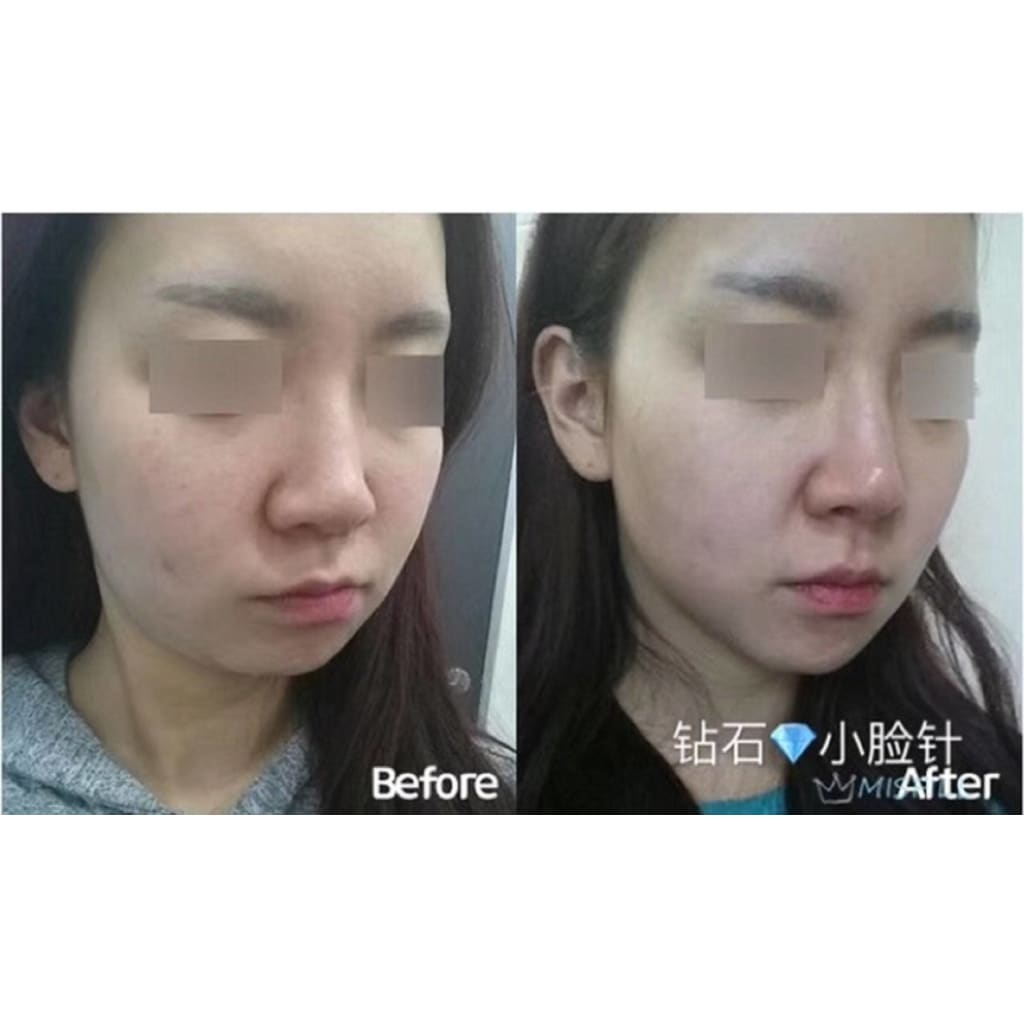 Misfill Diamond Face Slimming / Shaping Moonspells Beauty