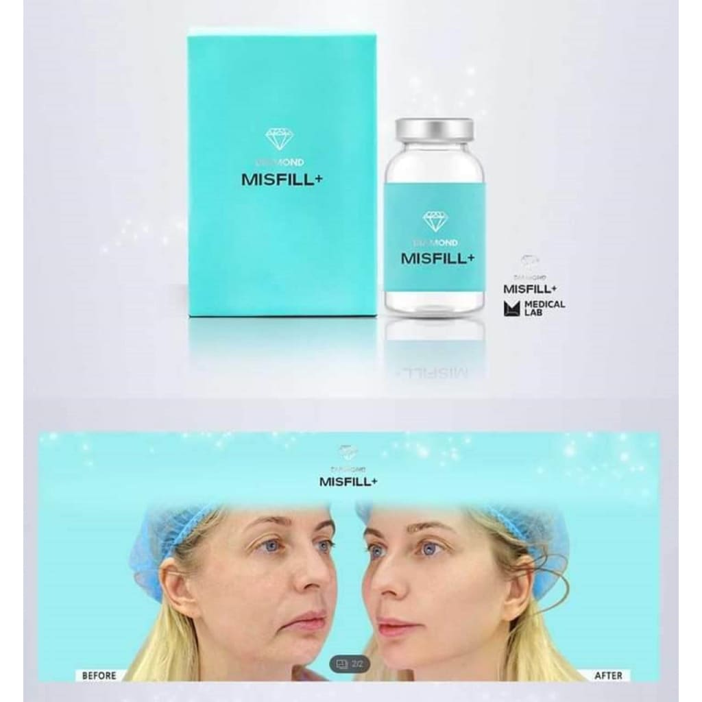 Misfill Diamond Face Slimming / Shaping Moonspells Beauty