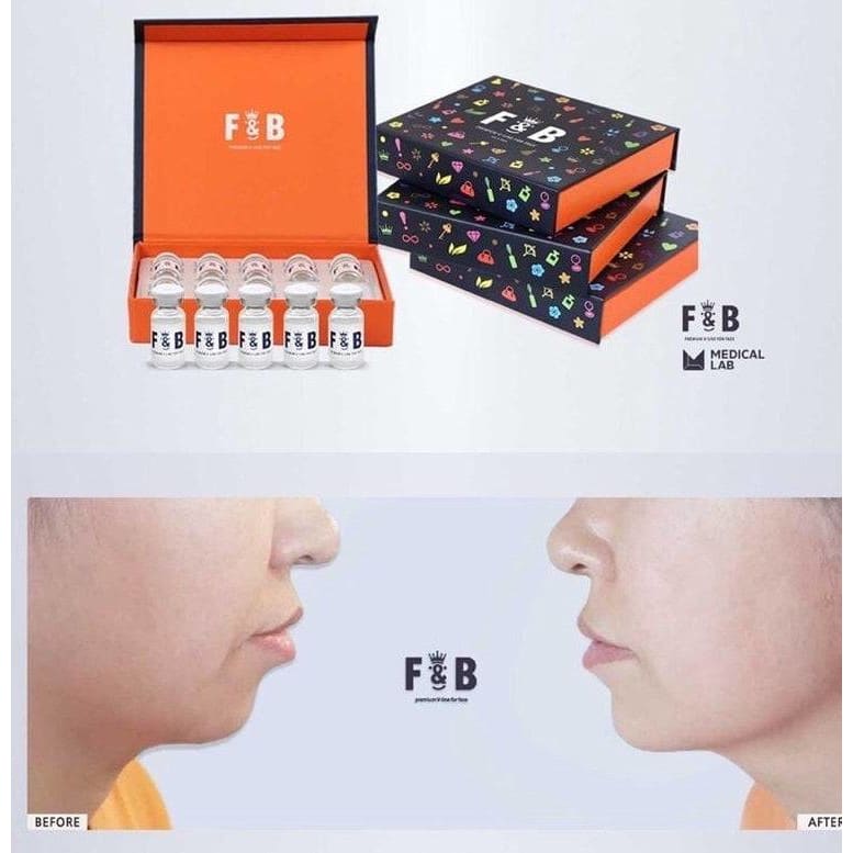 Misfill F & B Fat Dissolving Treatment Moonspells Beauty