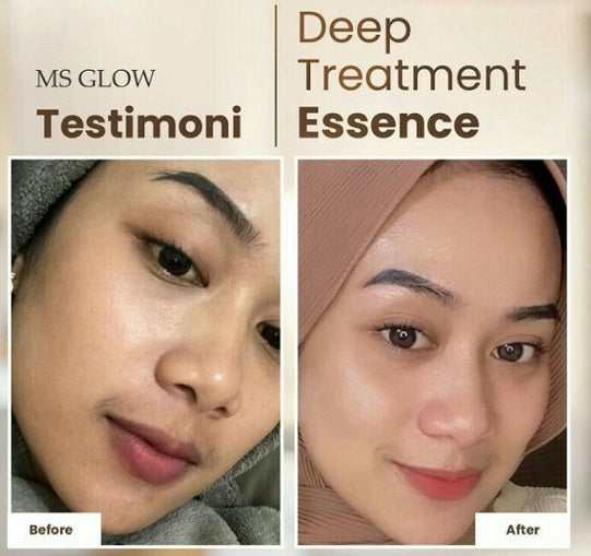 Ms Glow Deep Treatment Essence with Salmon DNA Moonspells Beauty