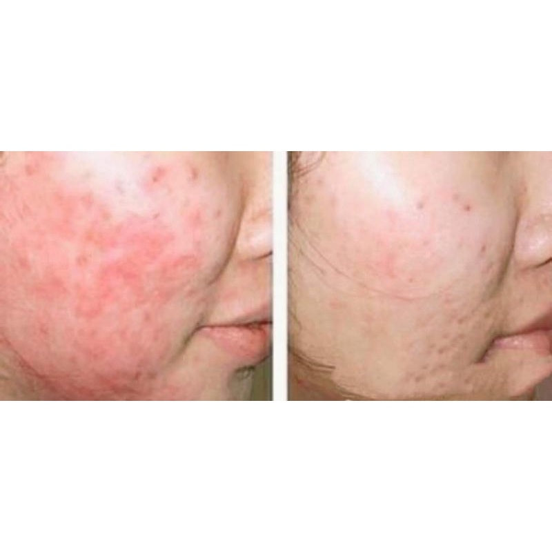 Nanguang Bisotin (B Complex) Moonspells Beauty