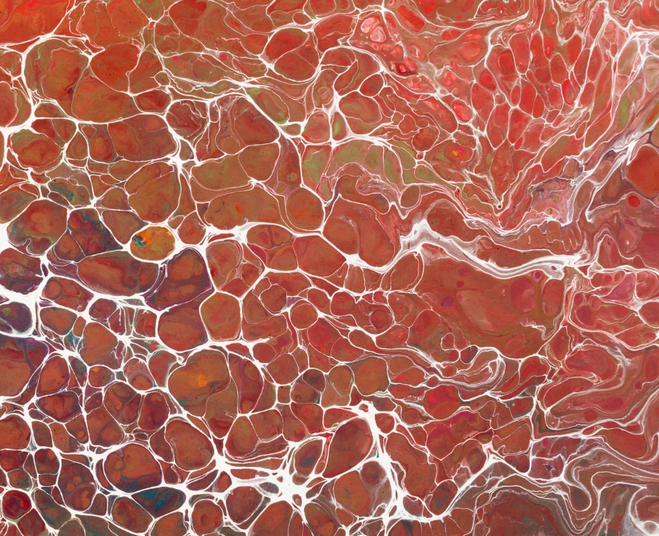 Treg Cells Paving the Way for Immune Cell Healing