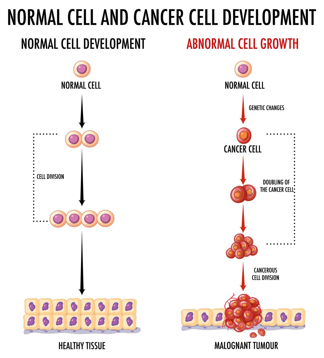Stem Cell Transplants to Combat Graft-Versus-Host Disease