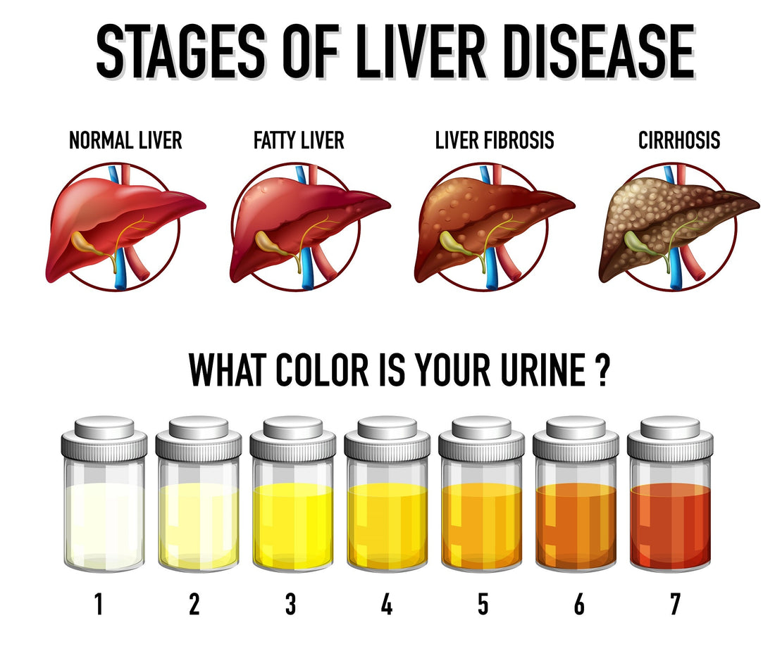 The Rising Epidemic of Preventable Fatty Liver Disease Moonspells Beauty