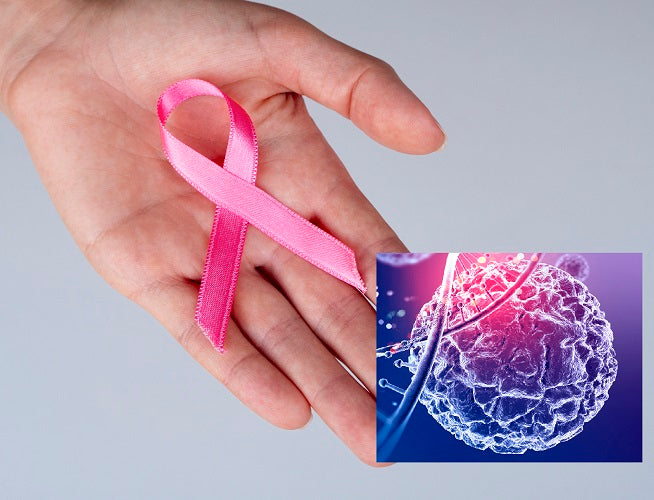 The Potential of Stem Cell Therapy in Breast Cancer Treatment