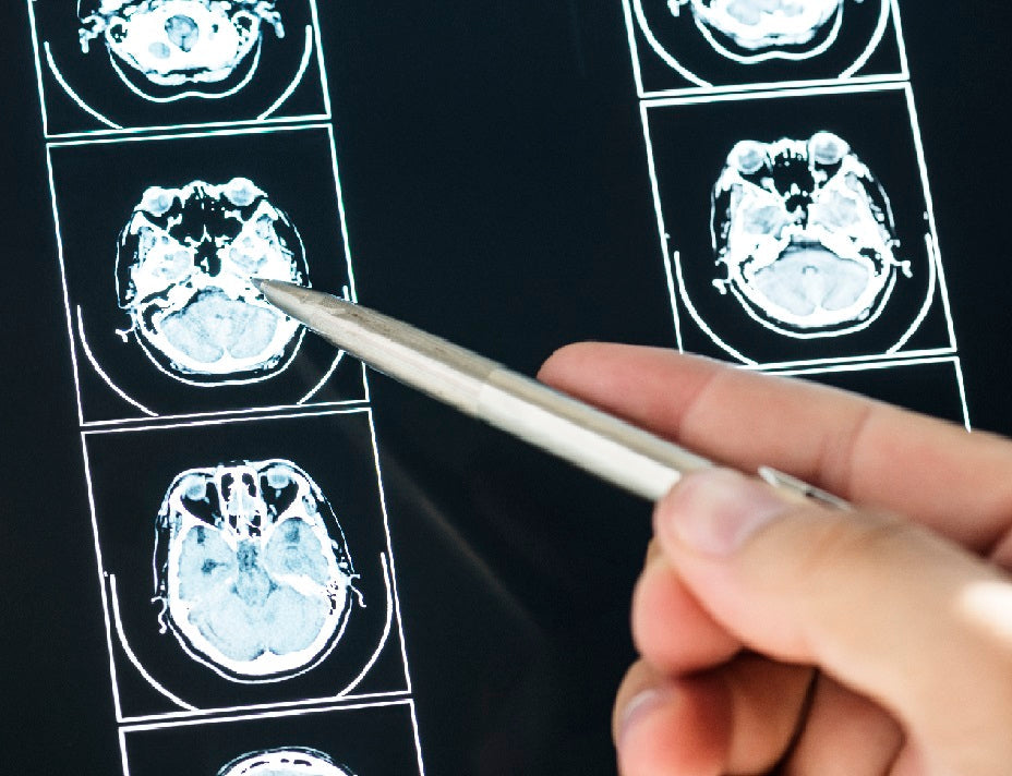 The Convergence of Stem Cell and Gene Therapy for Neurological Repair