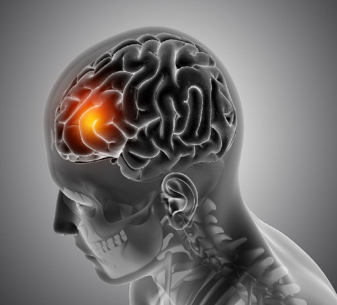 Understanding Glioblastoma and Its Systemic Effects