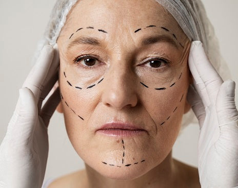 Revolutionizing Facial Rejuvenation with Adipose-Derived Stem Cells