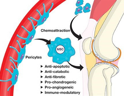 Stem Cell Therapy for Knee Repair and Regeneration