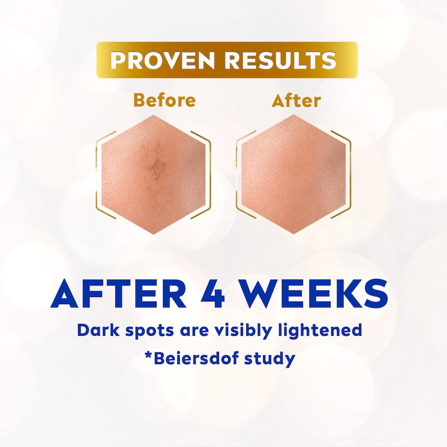 NIVEA Luminous630 Anti Dark Spot Treatment Set - Moonspells Beauty