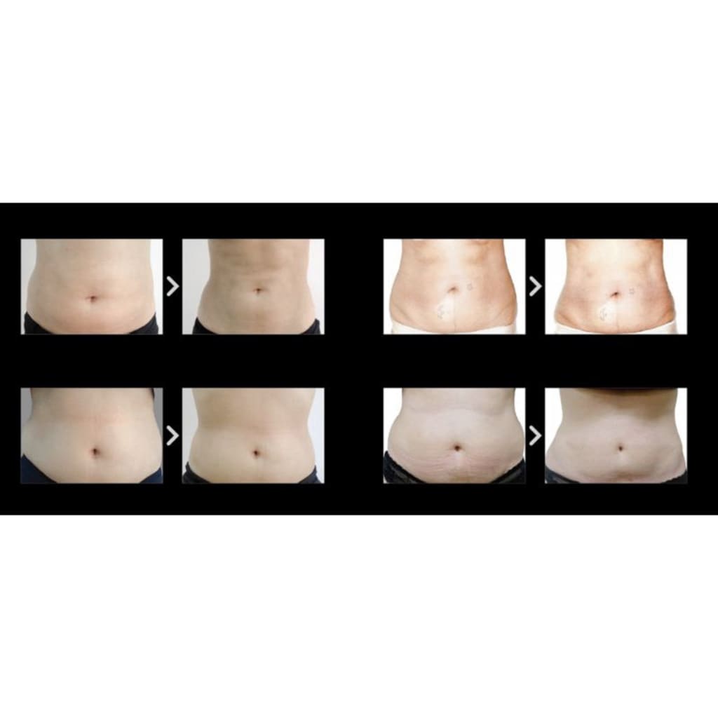 Dermaheal PTx Platinum LL - Moonspells Beauty