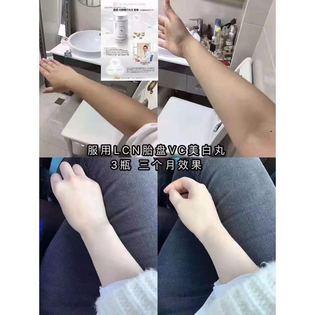 JBP LNC Placenta VC White Moonspells Beauty