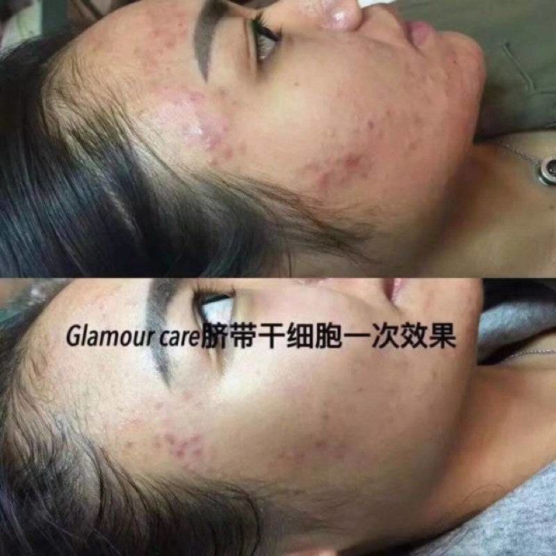 Korea Glamour Care SCM Stem Cells - Moonspells Beauty