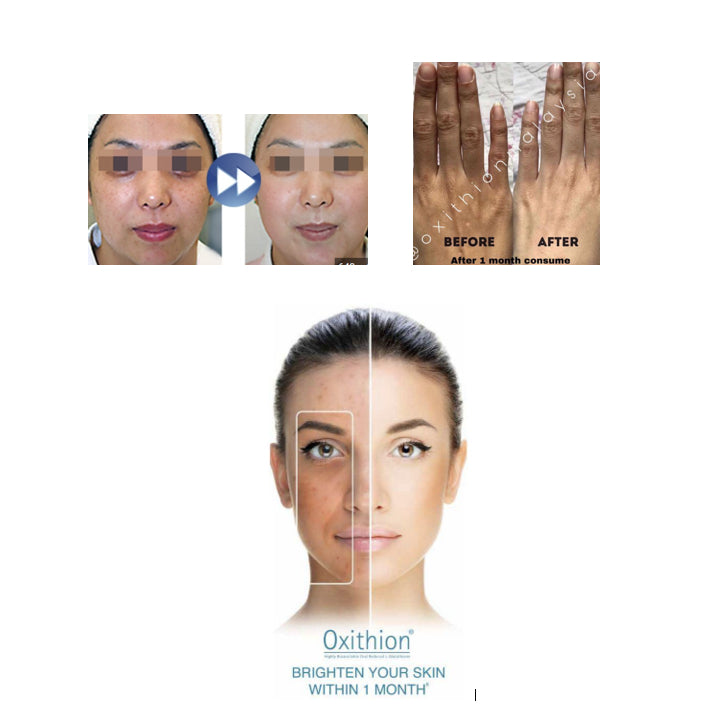 Oxithion Sublingual Tablets - Moonspells Beauty