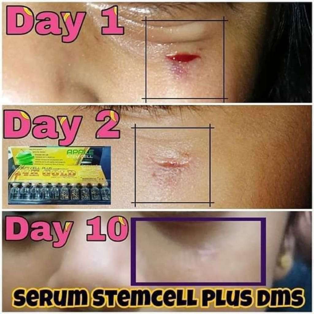 Super Stem Cell 24k Gold (Supernova DMS360) Moonspells Beauty