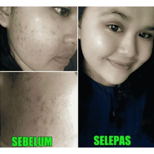 Super Stem Cell 24k Gold (Supernova DMS360) Moonspells Beauty