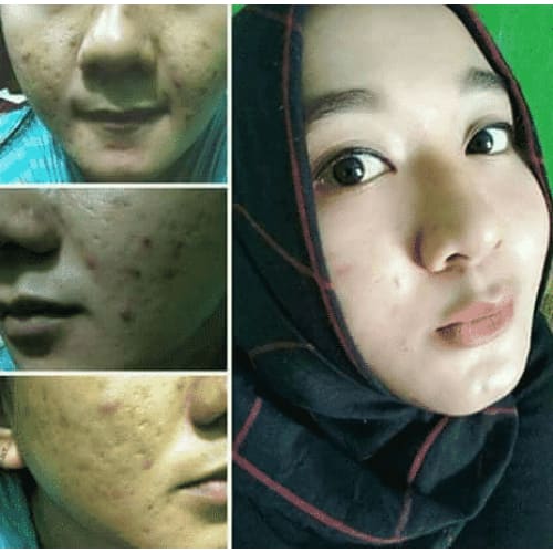 Super Stem Cell 24k Gold (Supernova DMS360) Moonspells Beauty