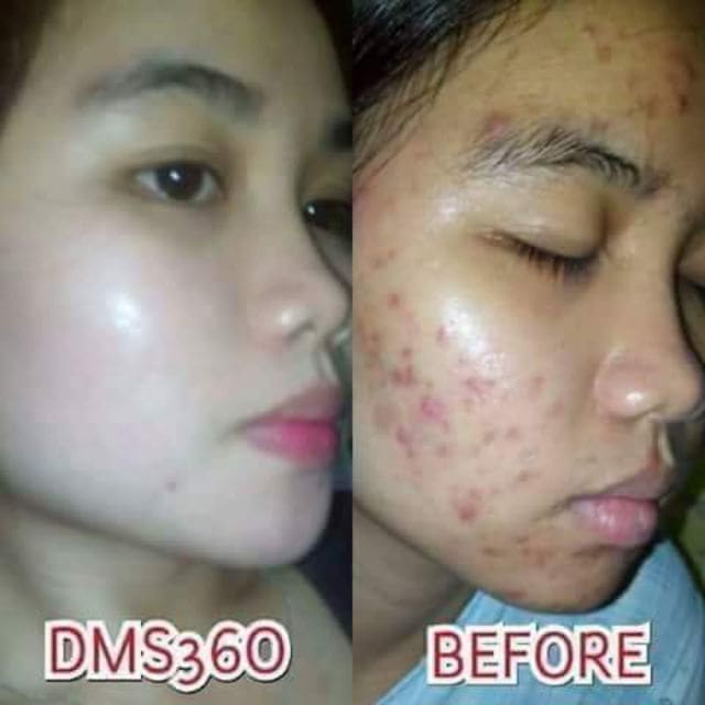 Super Stem Cell 24k Gold (Supernova DMS360) Moonspells Beauty