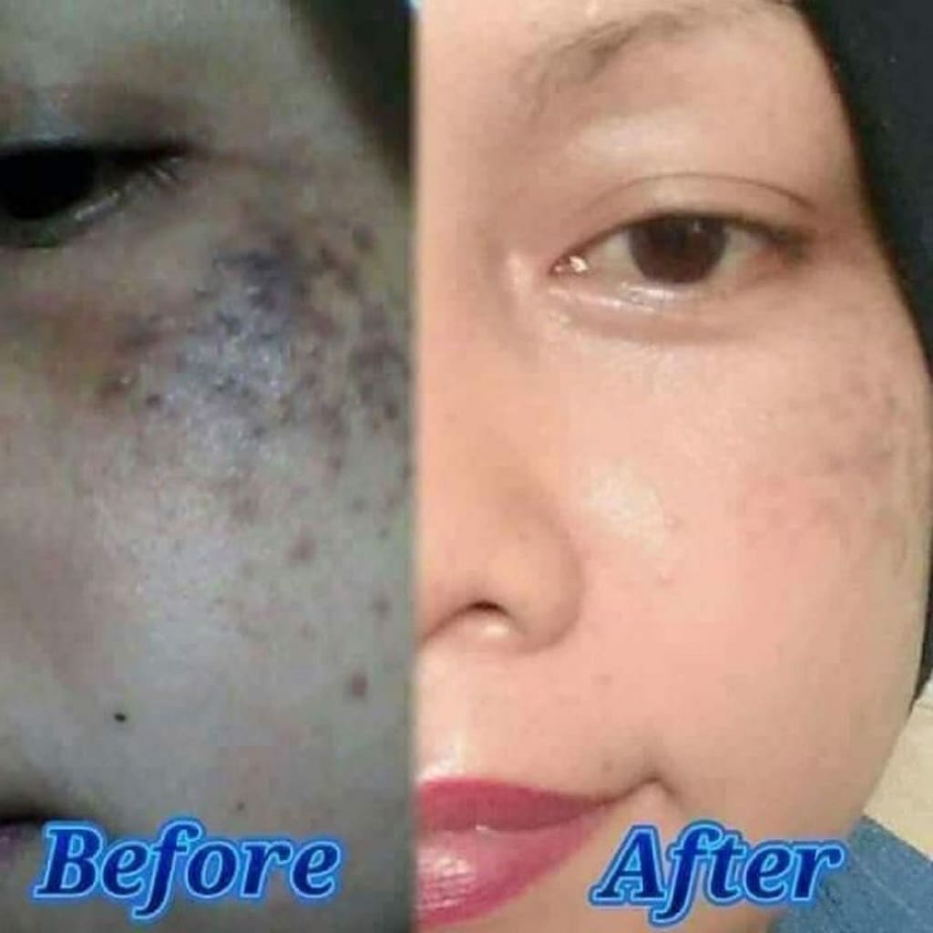 Super Stem Cell 24k Gold (Supernova DMS360) Moonspells Beauty