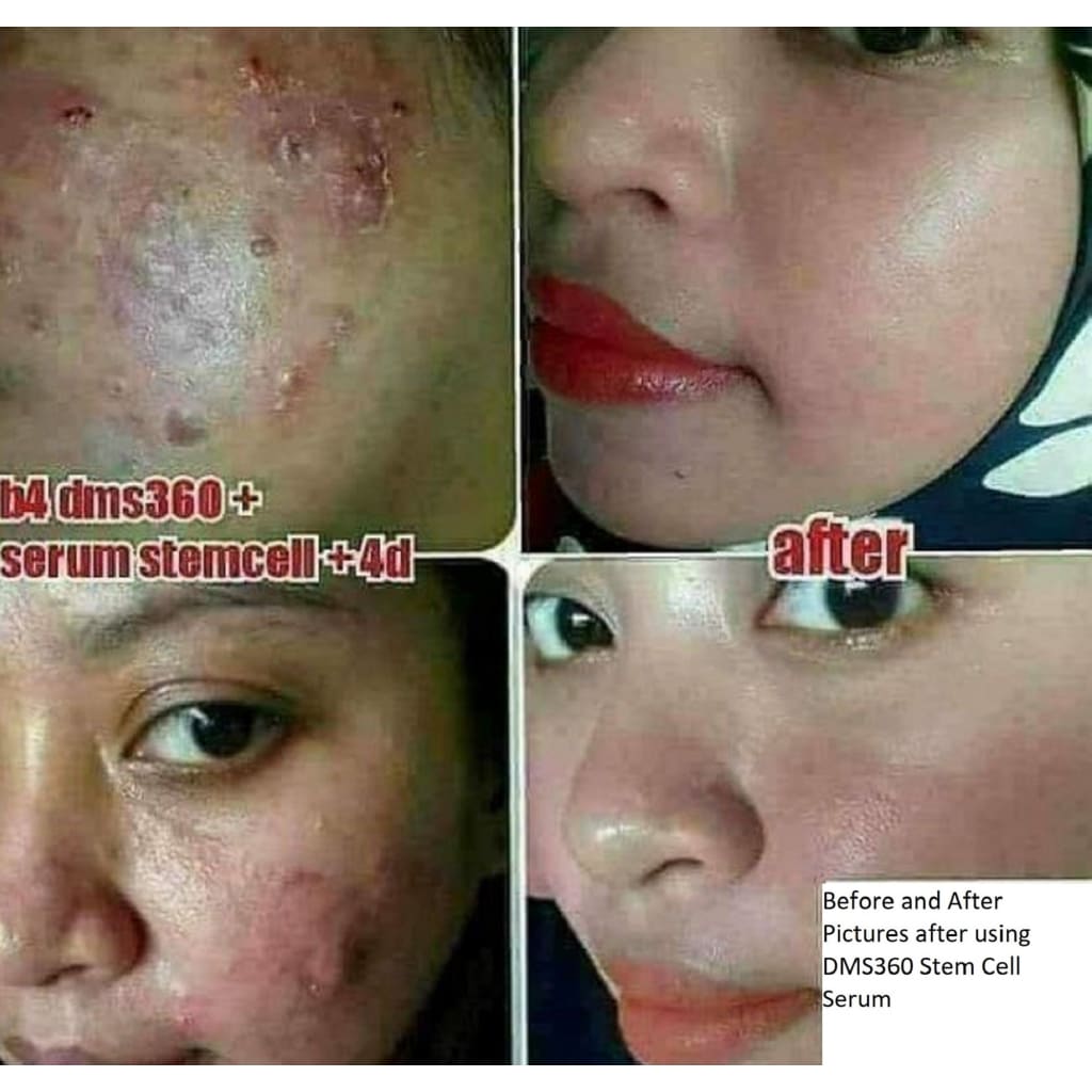 Super Stem Cell 24k Gold (Supernova DMS360) Moonspells Beauty